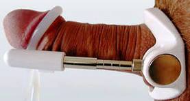 УДЛИНЕНИЕ ПОЛОВОГО ЧЛЕНА – ЛИГАМЕНТОТОМИЯ